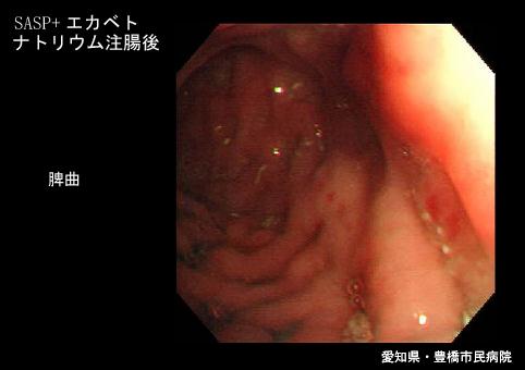 画像ID:5732