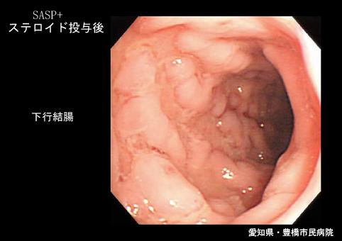 画像ID:5736