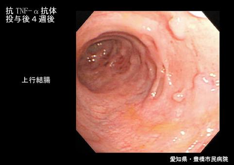 画像ID:5740