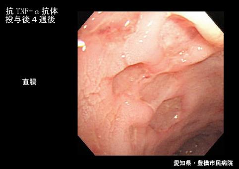 画像ID:5745