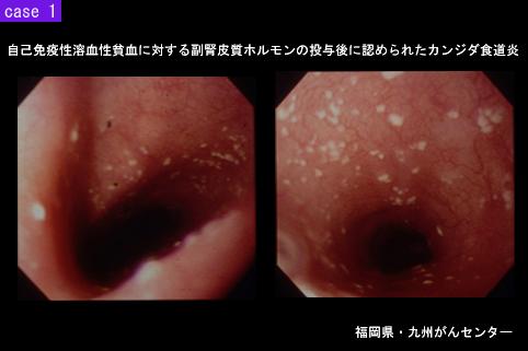 画像ID:5754