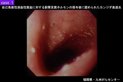 画像ID:5755
