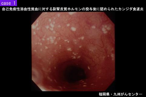画像ID:5756