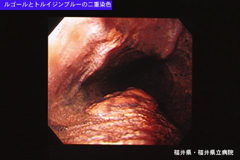 画像ID:5790