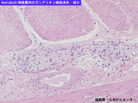 画像ID:5884