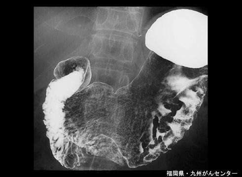 画像ID:5890