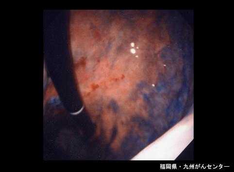 画像ID:5898