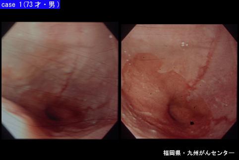 画像ID:5930
