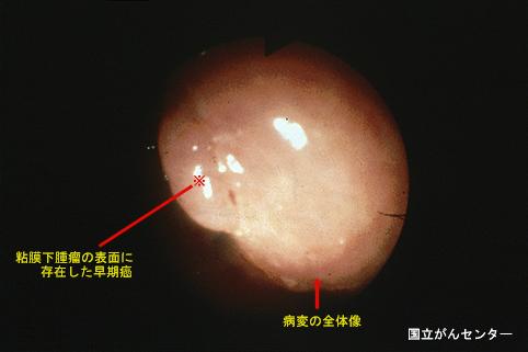 画像ID:6038