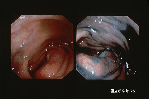 画像ID:6062