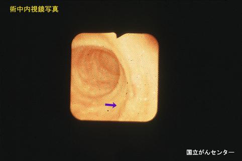 画像ID:6193