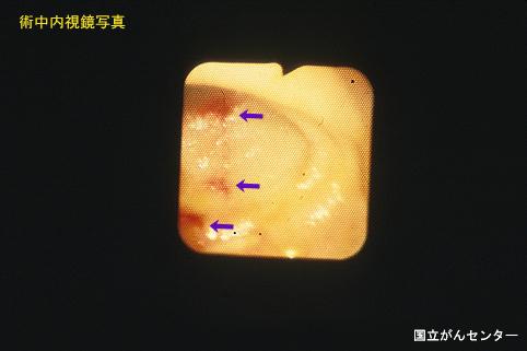 画像ID:6194