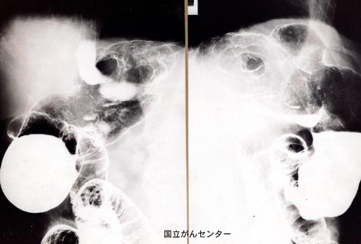 画像ID:6245