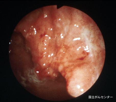 画像ID:6249