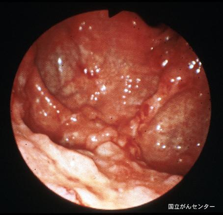 画像ID:6251