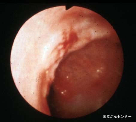 画像ID:6252