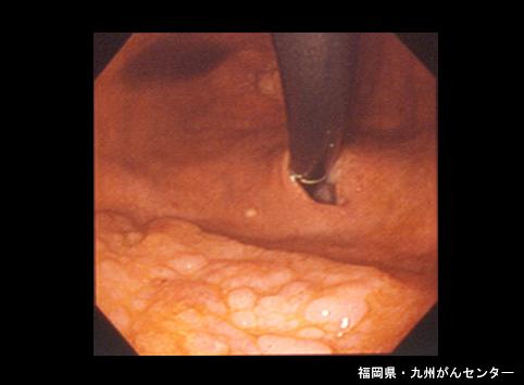 画像ID:6277