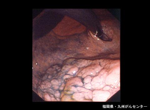 画像ID:6280