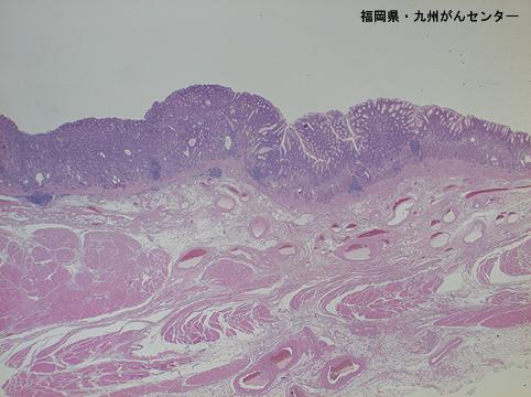 画像ID:6287