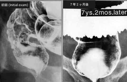 画像ID:1615