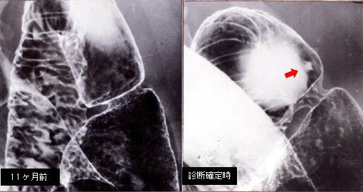 画像ID:2498