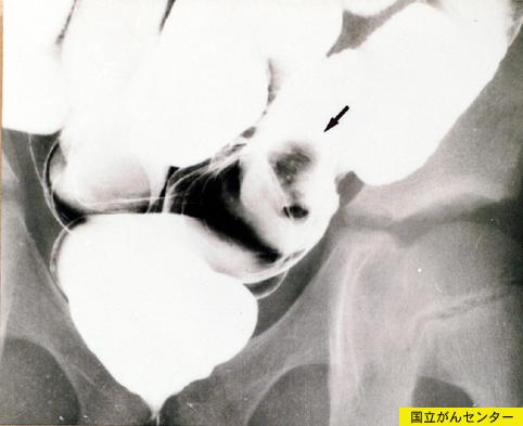 画像ID:6294