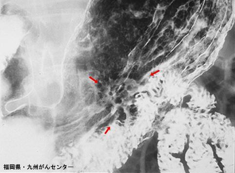 画像ID:6401