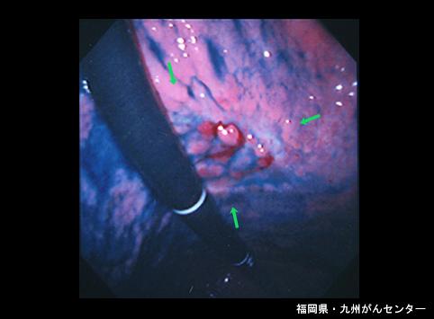 画像ID:6406