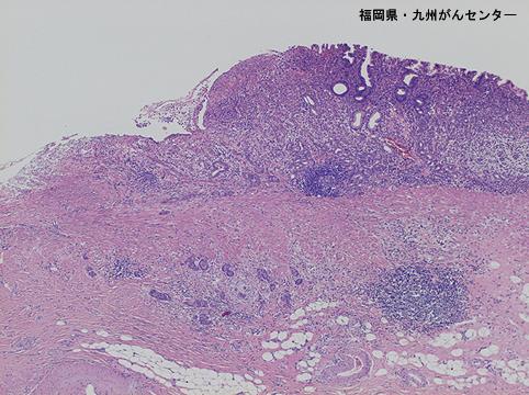 画像ID:6413