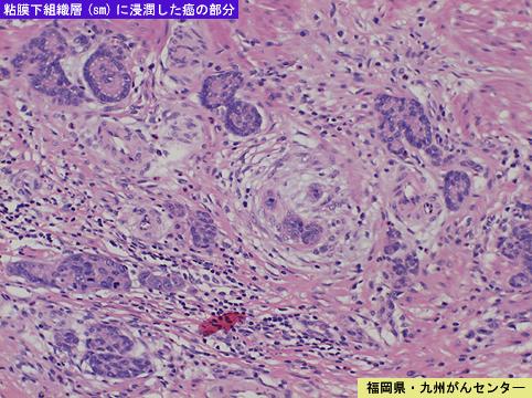 画像ID:6416