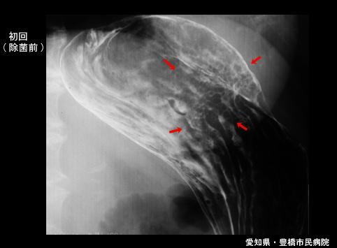 画像ID:6418