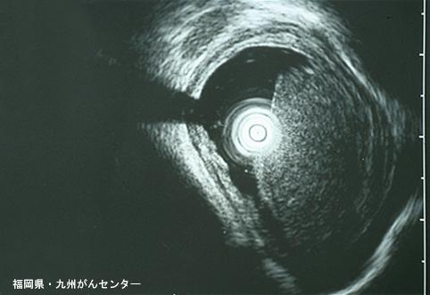 画像ID:6456
