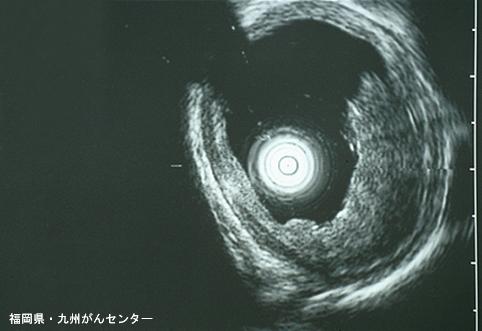 画像ID:6457