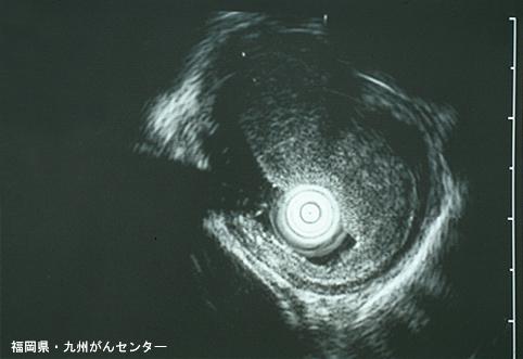 画像ID:6458