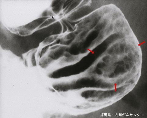 画像ID:6560