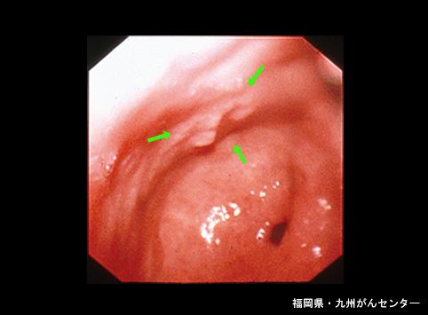 画像ID:6571