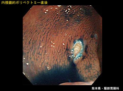 画像ID:6588