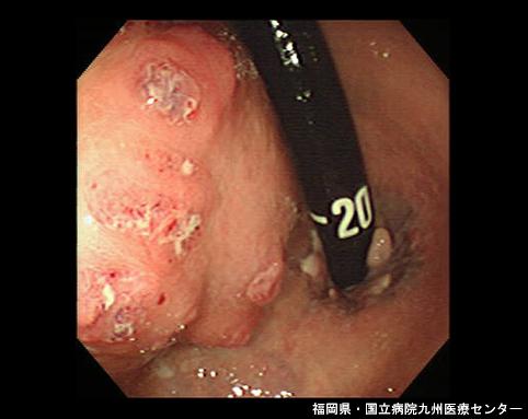 画像ID:6623
