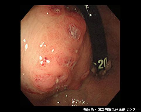 画像ID:6624