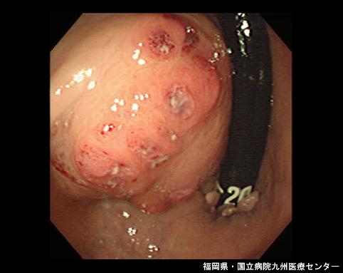 画像ID:6625