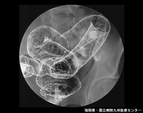 画像ID:6632