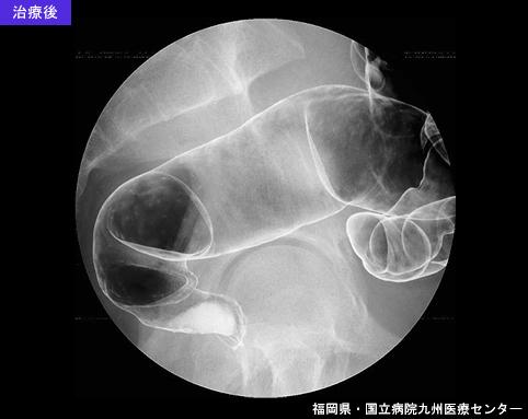 画像ID:6637