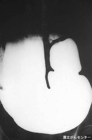 画像ID:6646