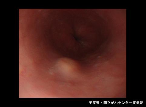 画像ID:6702