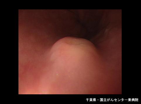 画像ID:6704