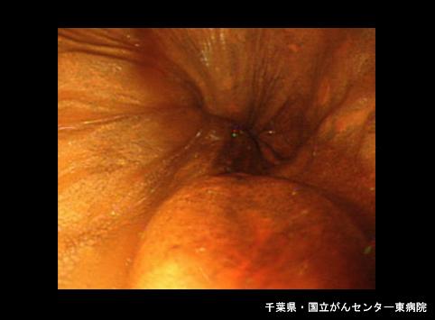 画像ID:6708