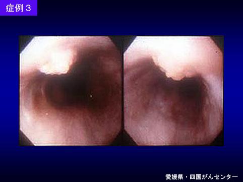 画像ID:6718