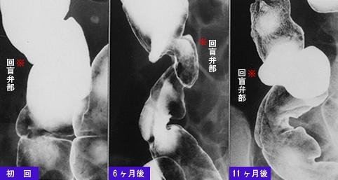 画像ID:7332