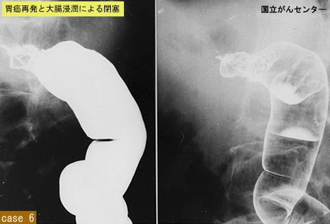 画像ID:7416