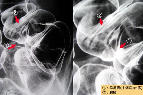 画像ID:7885